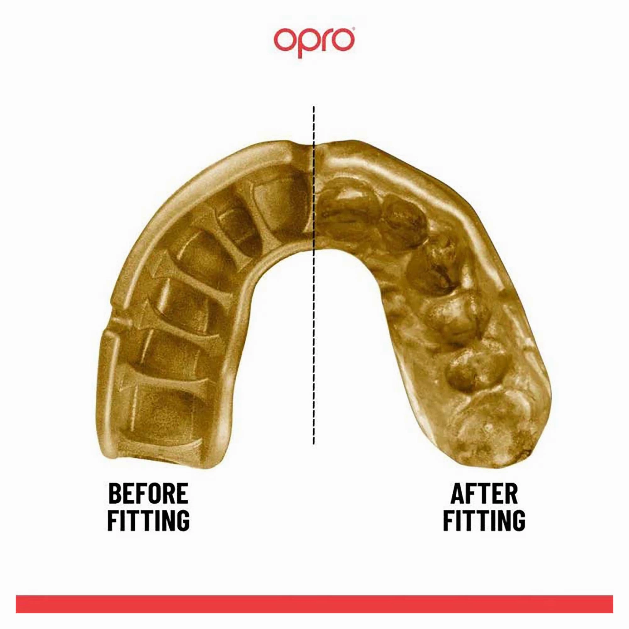 Adult's Self-Fit Mouthguard
